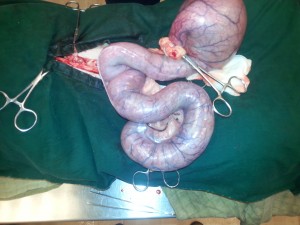 Pyometra, een met pus gevulde ontstoken baarmoeder